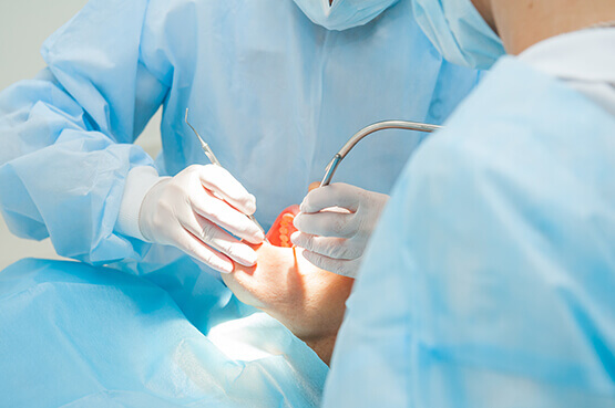 Temecula, CA Dental Implants