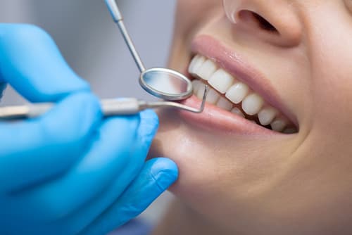 Are you put to sleep for a dental implant