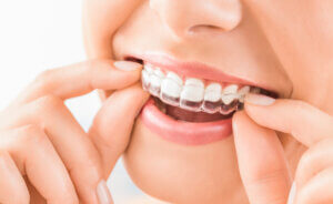 Top Tips for Avoiding Dental Emergencies