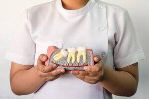 What are some problems associated with impacted wisdom teeth