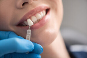 What are frequent questions concerning dental implants