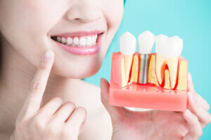 Who is the leading dental implant specialist in Perris, CA