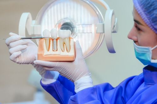 Where can I find a trusted dentist implant specialist in Temecula