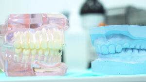 reliable dental implants specialist in Scripps Ranch
