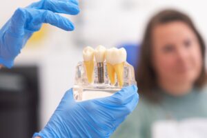 What are common mistakes in dental implant maintenance?