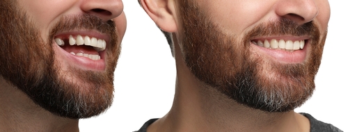 dental implant specialist mira mesa​