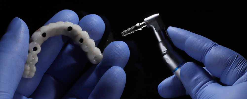 What is the difference between All-on-4 & traditional dentures