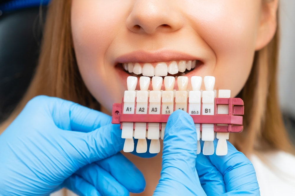 How long does it take for dental implants to osseointegrate