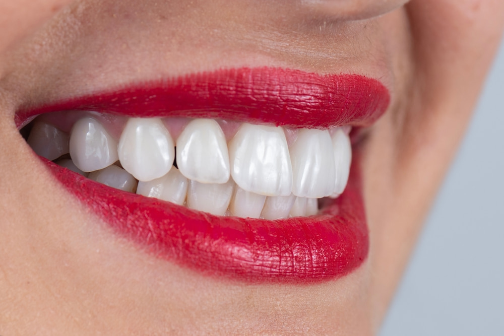 natural-looking All-on-4 implants in Vista, CA