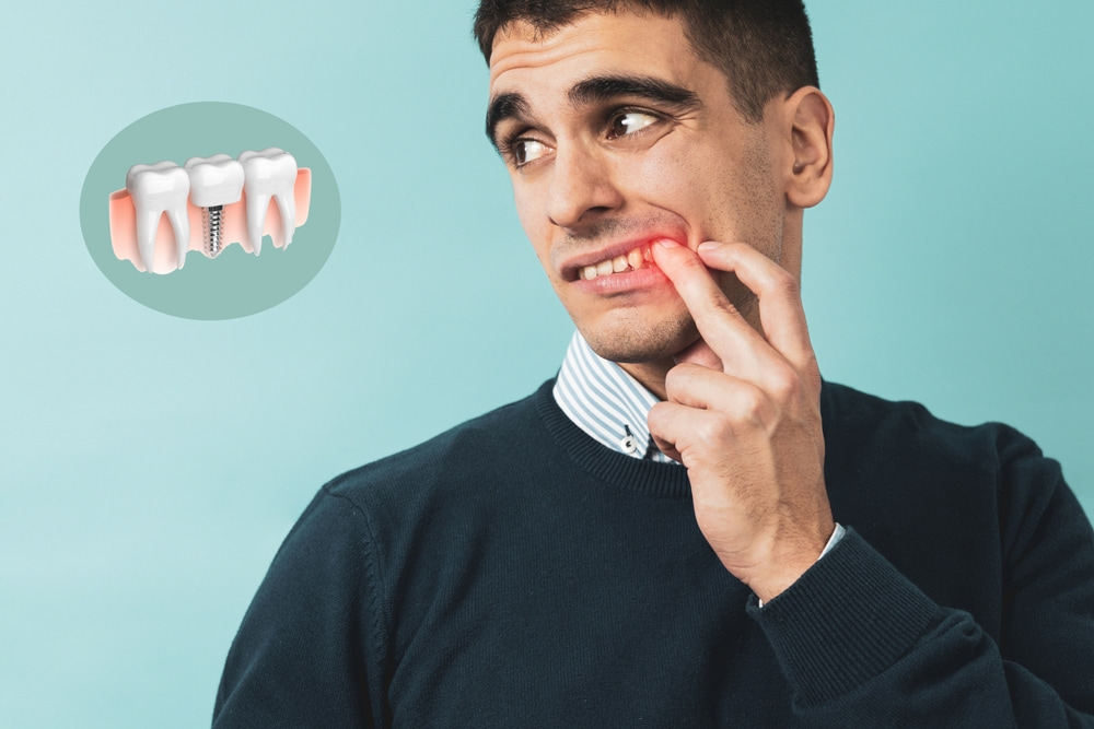 specialist in dental implants in Oceanside, CA