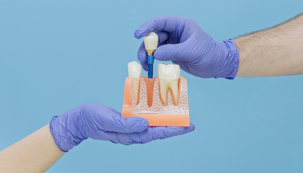 Does a loose implant always mean failure