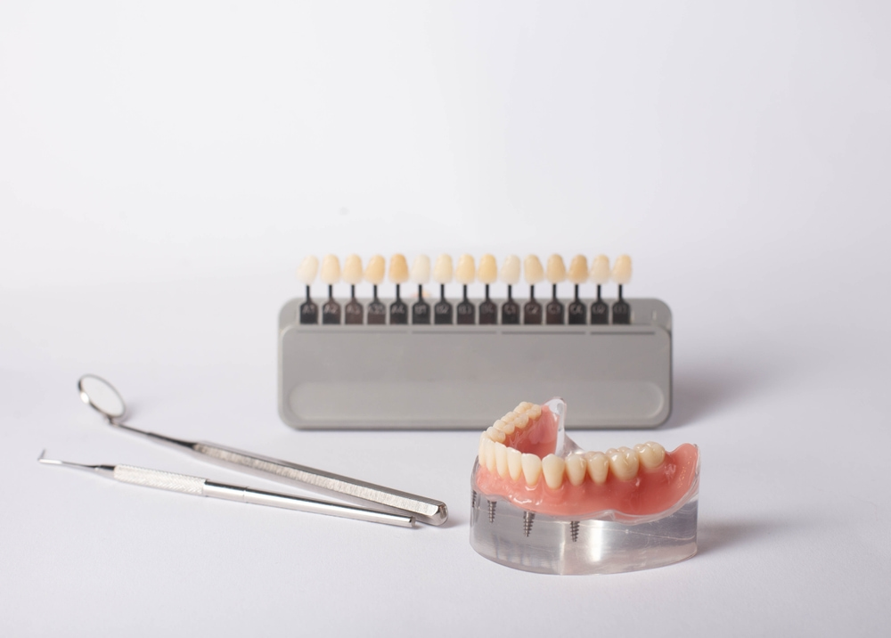 When might single-arch All-on-4 treatment make sense